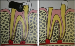 dolor dental