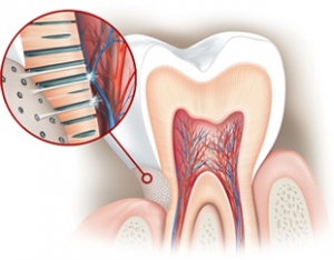 sensibilidad dental 